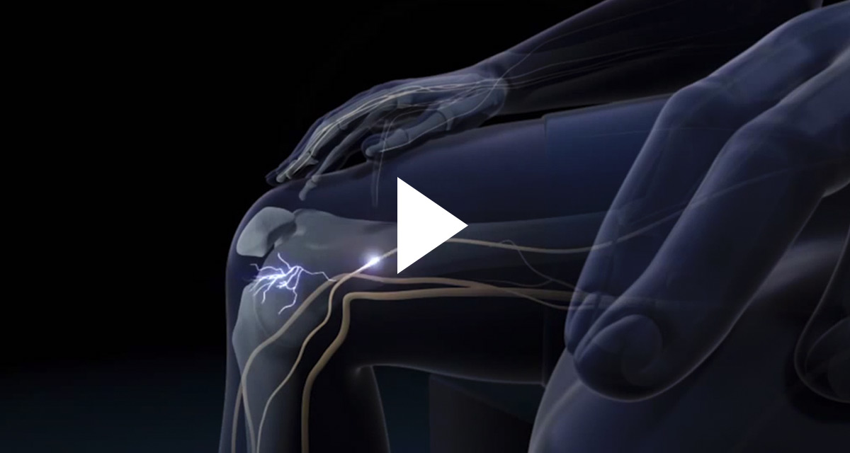 Common Pain Syndrome