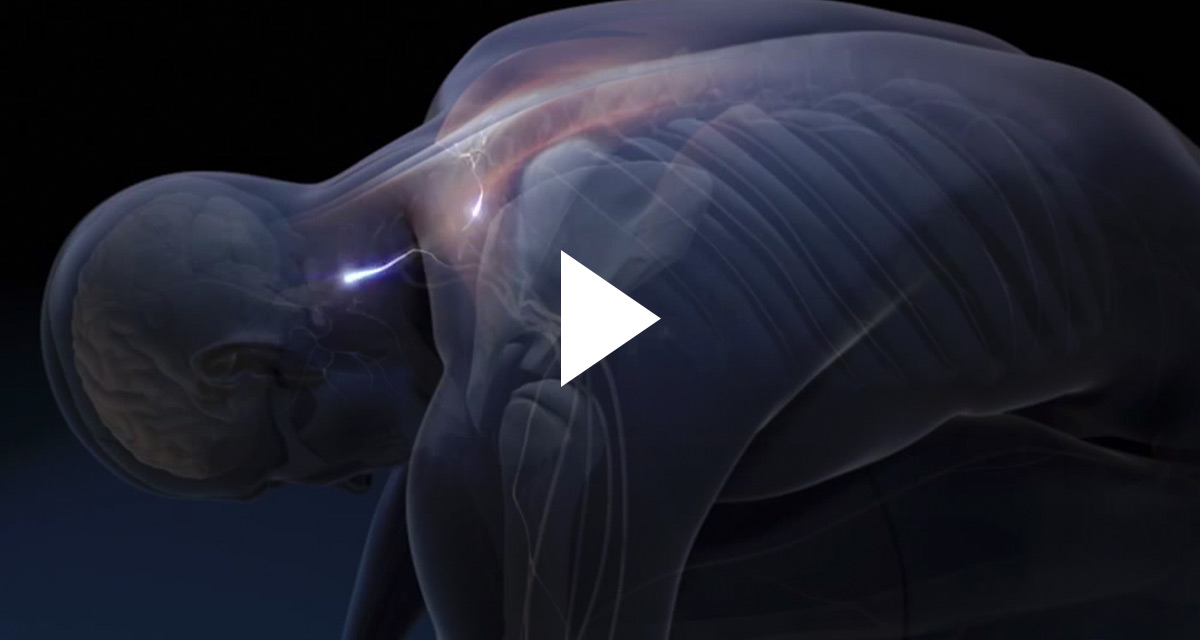 Common Pain Syndrome